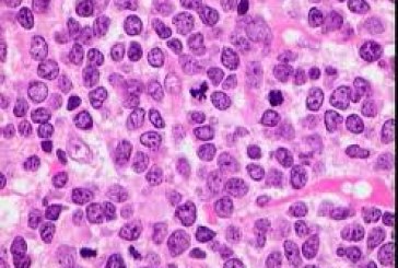 ¿Qué es la Leucemia?