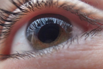 El glaucoma podría ser una enfermedad autoinmune